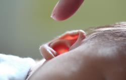 otitis_media_bahaya_kolesteatoma