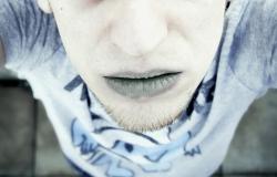 tanda_penyakit_jantung_bibir_biru