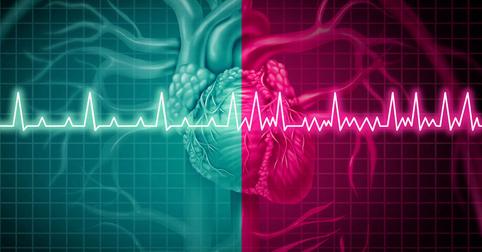 mencegah gangguan irama jantung fibrilasi atrium kambuh