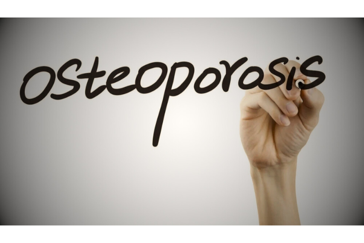 orang indonesia berisiko osteoporosis