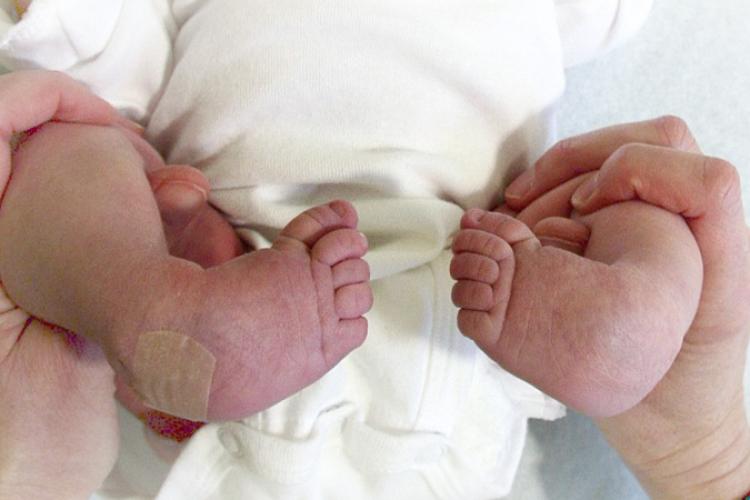 penanganan kaki bengkok pada bayi