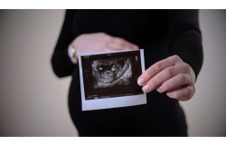 cegah anemia defisiensi besi pada bayi