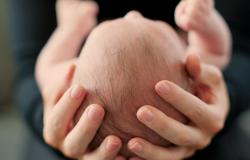 bayi lahir dengan 3 penis