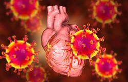 vaksin mRNA sebabkan radang otot jantung 